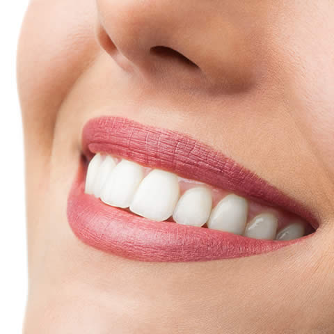 Beautiful smile
